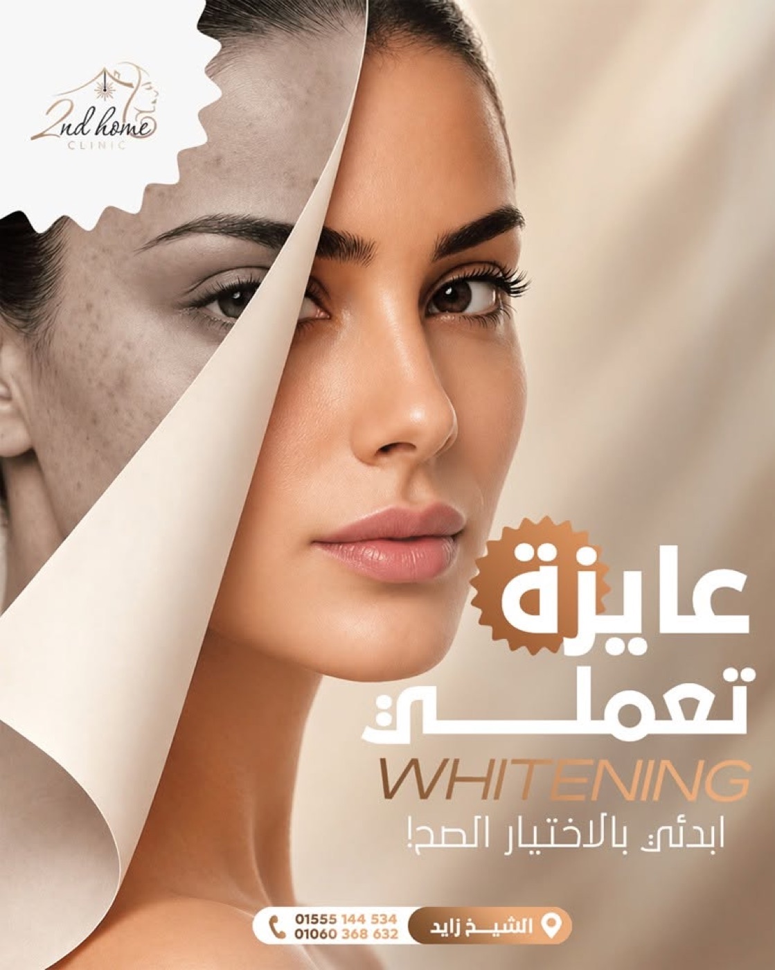 Whitening - start with the right choice